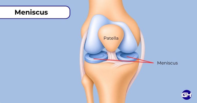 Meniscus Injury: What it means and how to recover without surgery